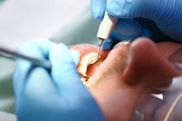 Best Emergency Dentist Open Today  in Dover Base Housing, DE