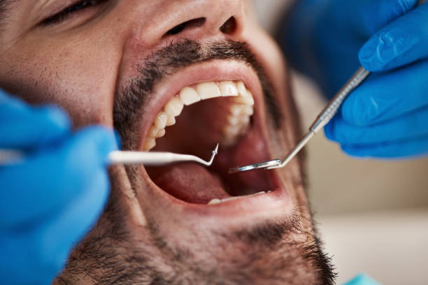 Best Emergency Tooth Extraction  in Dover Base Housing, DE